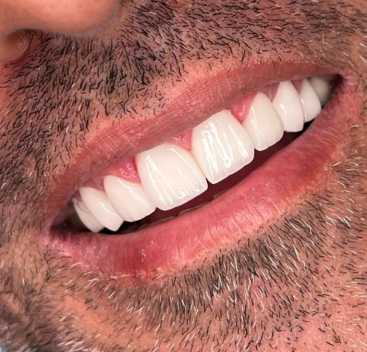 دندانپزشکی و ترمیم زیبایی